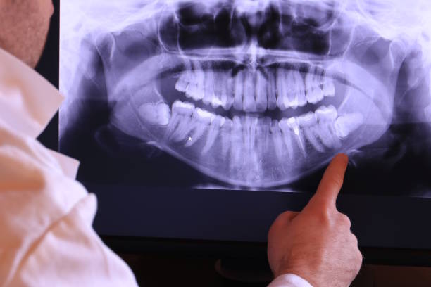 Best Same-Day Emergency Dental Services in Lake Shore, WA