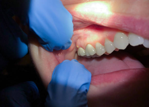 Best Emergency TMJ Treatment in Lake Shore, WA