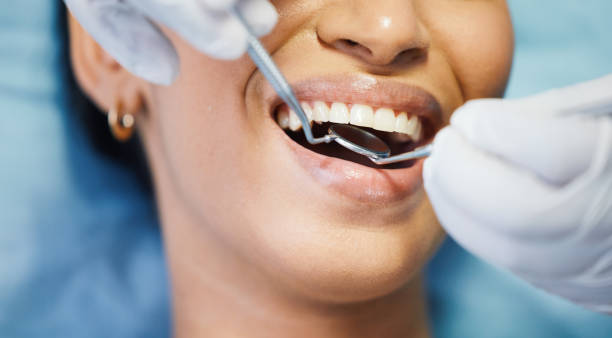 Best Pediatric Emergency Dentist in Lake Shore, WA