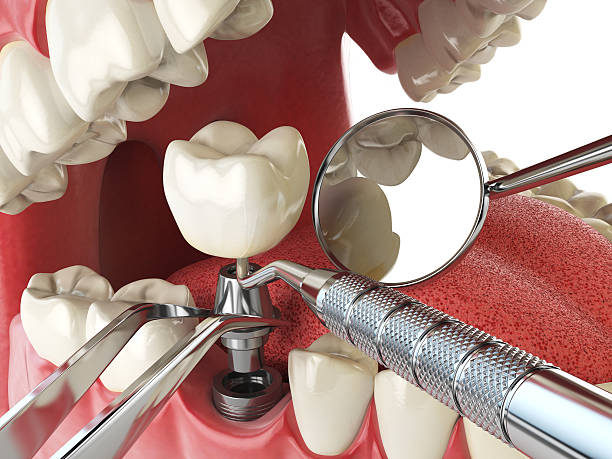 Best Weekend Emergency Dentist in Lake Shore, WA